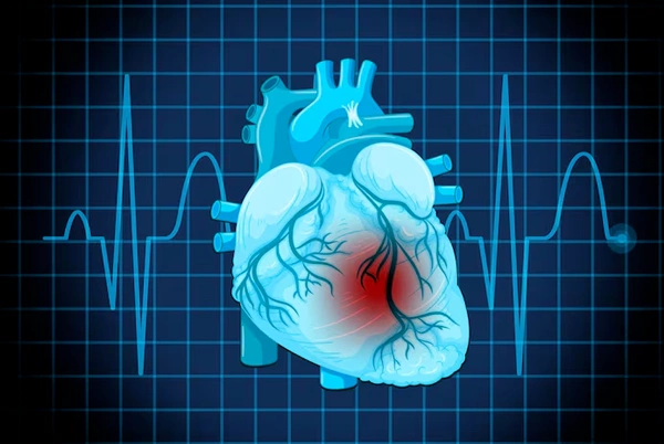 Interventional Cardiology