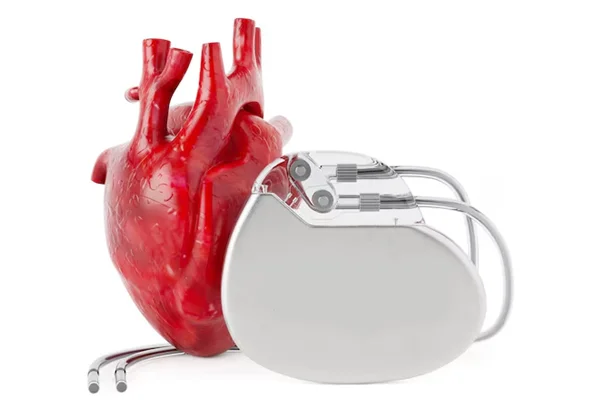 Pacemaker Implantation